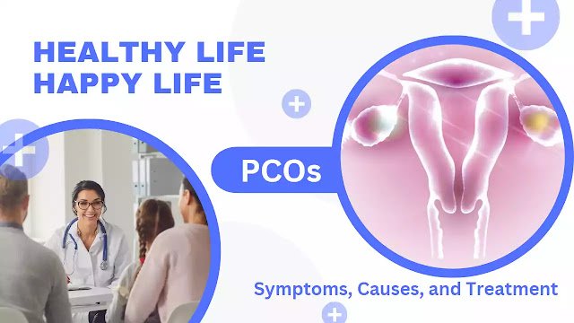 Polycystic Ovary Syndrome : Causes and Treatment In 2023