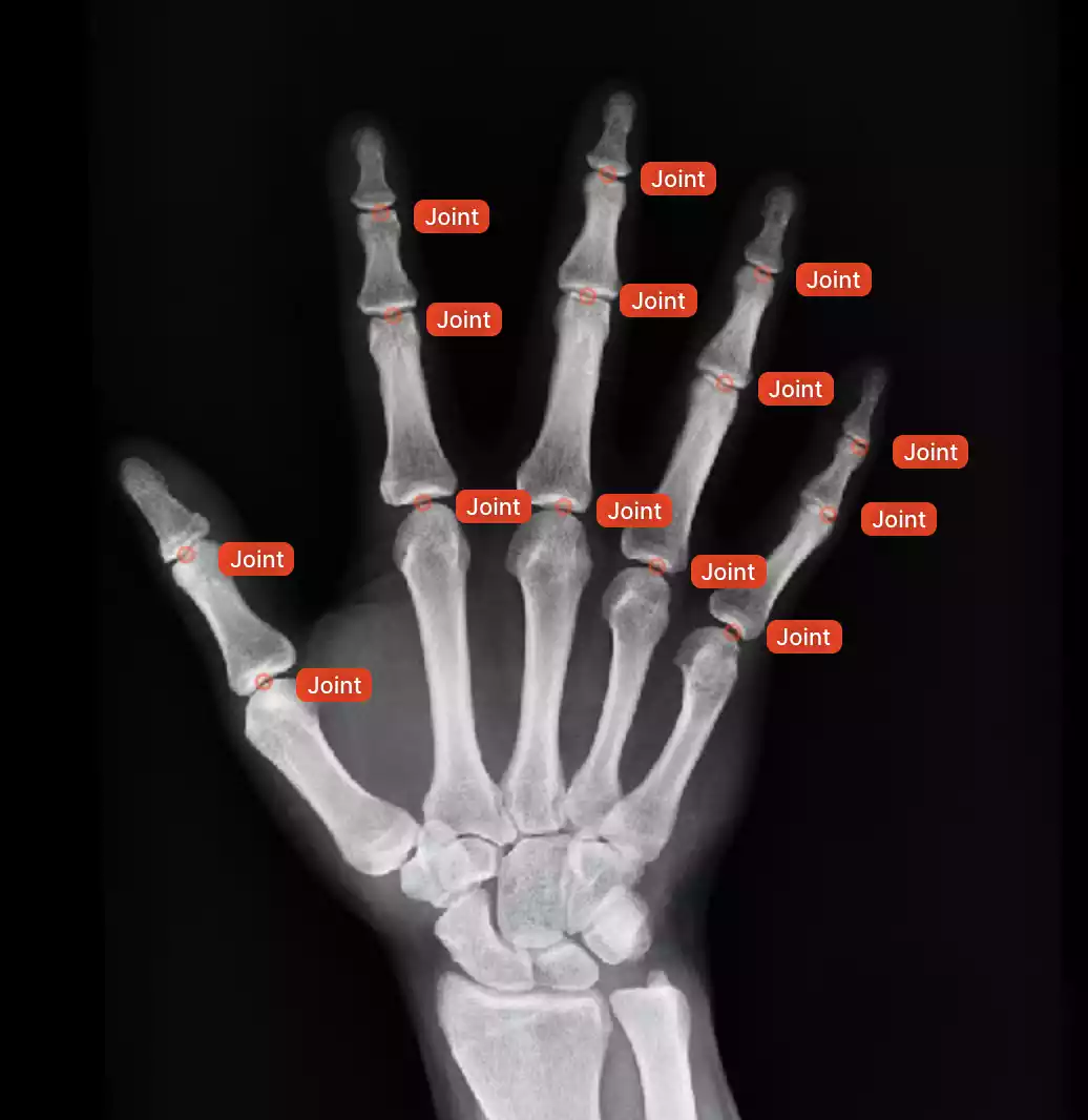 Medical Imaging Analysis